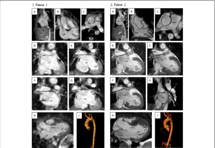 Fig. 8 Representative 3D WH bSSFP images from two patients obtained with iNAV. This figure shows the range of image quality that still allowed complete morphological diagnosis (ie