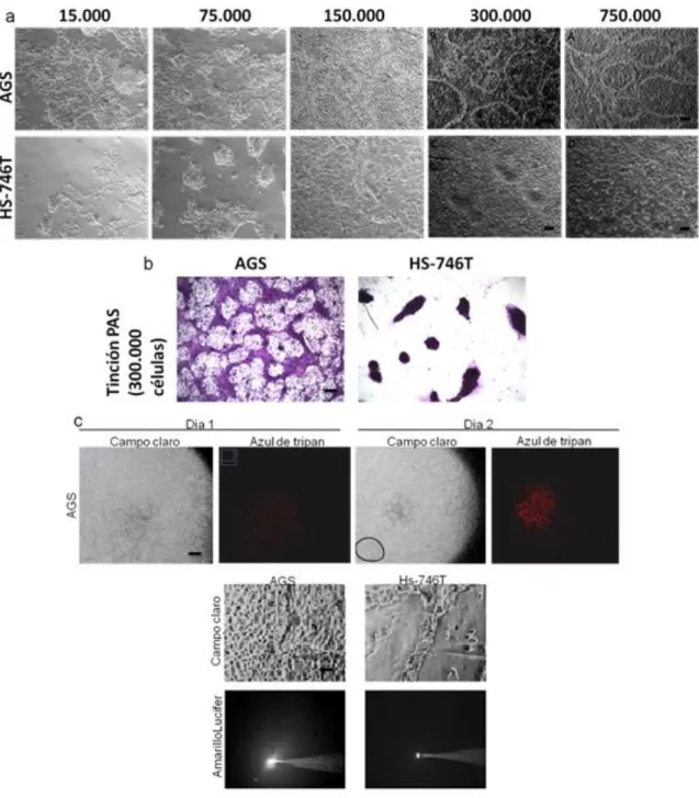 Figura 9: Caracterización del proceso de VM en cáncer gástrico. Caracterización del proceso de VM en dos  líneas cáncer gástrico