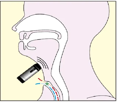 Figura 1.4  Posición de la Electrolaringe cervical .  1.4.1  Tipos de electrolaringes