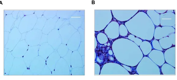 Figura  6.  Infiltrados  de  macrófagos  en  el  tejido  adiposo.  Secciones  del  tejido  adiposo de ratones delgados (A) y obesos (B)