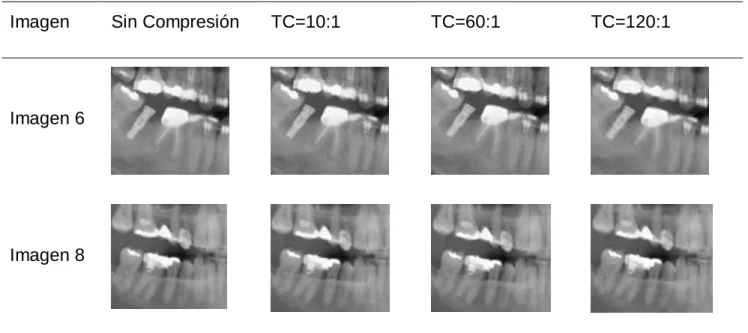 Tabla 4: Fragmentos de las imágenes 6 y 8 compactadas a diferentes TC. 
