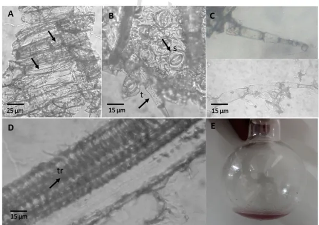 Fig. 3. Microscopic examination of leaf powder of Digitalis purpurea L. A: Epidermis, B: stomata (s) and trichomes (t), C: glandular trichomes with multicellular (four and five cells), uniseriate stalk and a unicellular head, D: simple pitted vessels and t