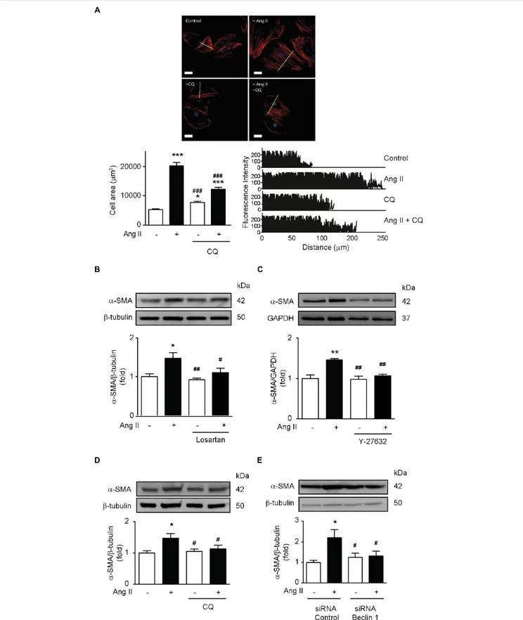 FIGURE 5 | Ang II-dependent autophagy elicits hypertrophy in VSMCs. (A) A7r5 cells were treated with or without Ang II 100 nM