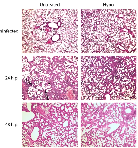 Figure  7:  Untreated  and  hypo  mice  have  similar  lung  tissue  damage.  Mice  were  intranasally  infected with 3x10 7  CFUs of  S