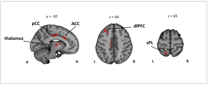 Figure 7: Conjunction analysis between the activation Musicians &gt; Controls for the encoding phase  of the contrasts [ASA &gt; P], [VSA &gt; P] and [DA &gt; P]