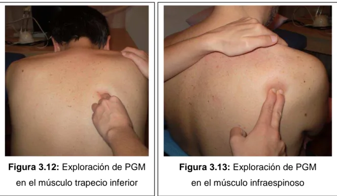 Figura 3.12: Exploración de PGM  en el músculo trapecio inferior 