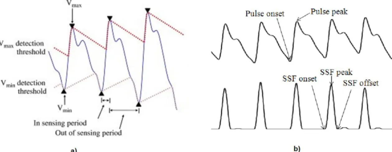 Figura 6. Detección de picos del PPG. a) Por umbrales dinámicos. [36].  b) Por función sumatoria de pendiente