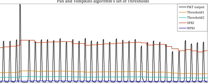 Figure 3.3-6. Example of Pan and Tompkins algorithm's Signal and noise level estimation and set of Thresholds 