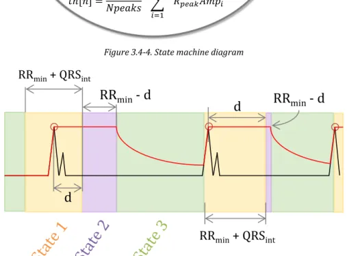 Figure 3.4-5. Correspondence between the FSM states and the ECG phase 