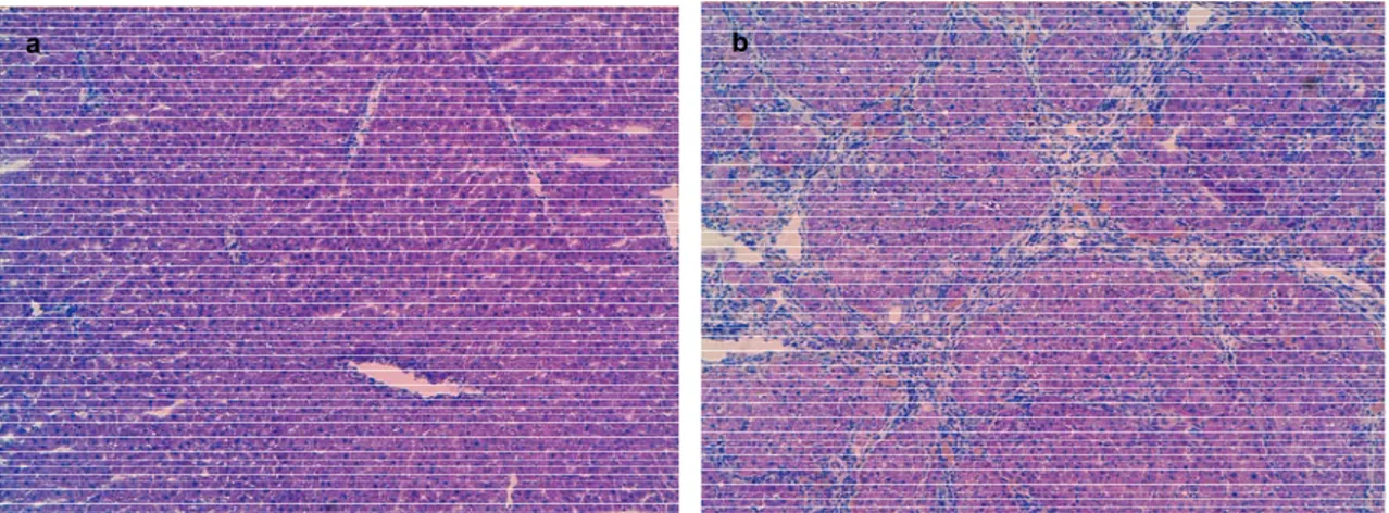 Figura 3. Imagen histológica de un hígado de rata sano (a) y otro cirrótico (b). Tinción con Hematoxilina- Hematoxilina-Eosina (100x)