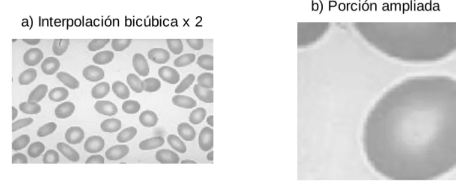 Figura 3. 6  a) Interpolación bicúbica por 2, que devuelve a la imagen a las dimensiones de 462 x 740