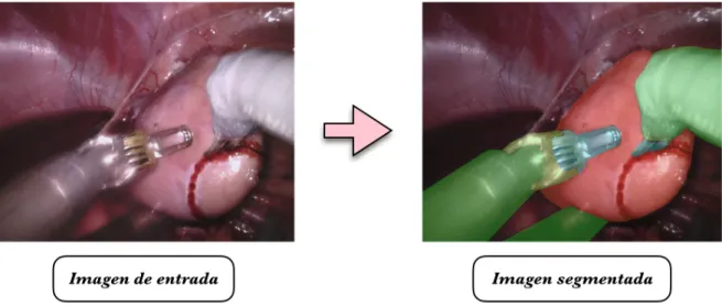 Figura 1.2: Esquema de segmentación semántica. Las diferentes clases se resaltan con diferente color en la imagen segmentada.
