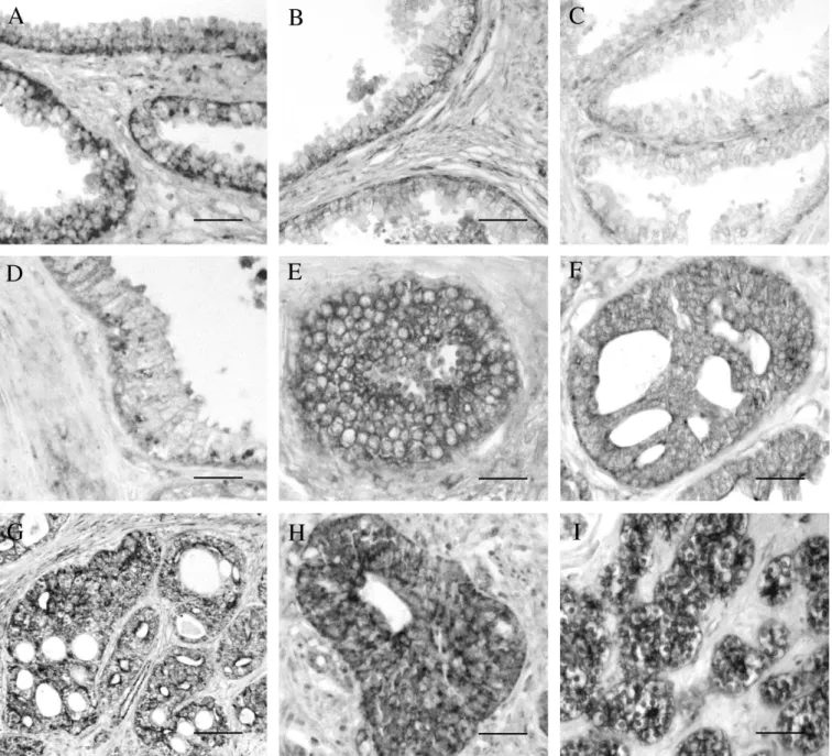Fig. 5. In normal prostate samples, the cytoplasm of epithelial cells presented positive immunoreaction to IRAK (A), TRAF-6 (B), p-IkB (C) and NF-κB- NF-κB-p50 (D)