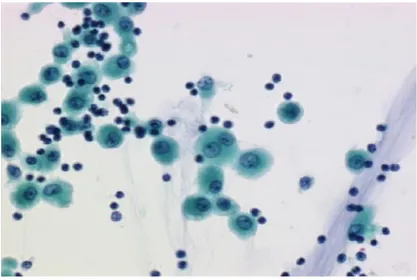 Figura 1.1. Muestra de células obtenidas de la citología bronquial. 