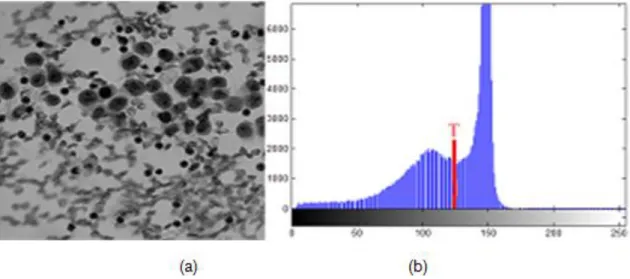 Figura 1.7.Muestra de un umbral bimodal. (a) Imagen en escala de grises, (b) Histograma bimodal con  umbral T señalizado