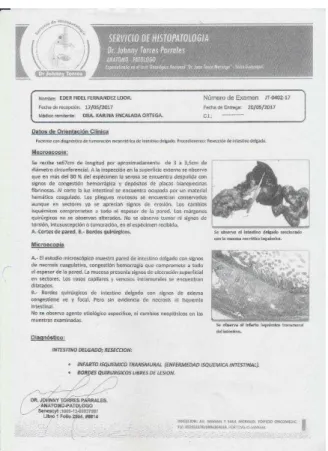 Figura 7: Visualización intraoperatoria de Isquemia intestinal. 