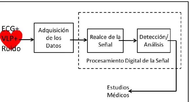 Figura 1. 4. Sistema para la detección y el análisis de VLPs 
