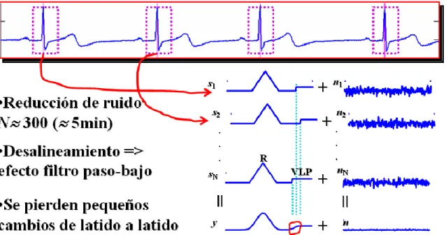 Figura 1. 5. Representación esquemática del promediado coherente de la señal  electrocardiográfica 
