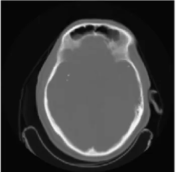 Fig. 17 Imagen  de RMN de  cráneo  de tipo  centrada  con espacio  en los  bordes que  permite  realizar  anotaciones