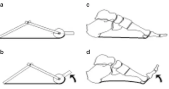Ilustración	 4 :  Mecanismo  de  Windlass.  Extraido  de  The  mechanics  of  the  foot  II