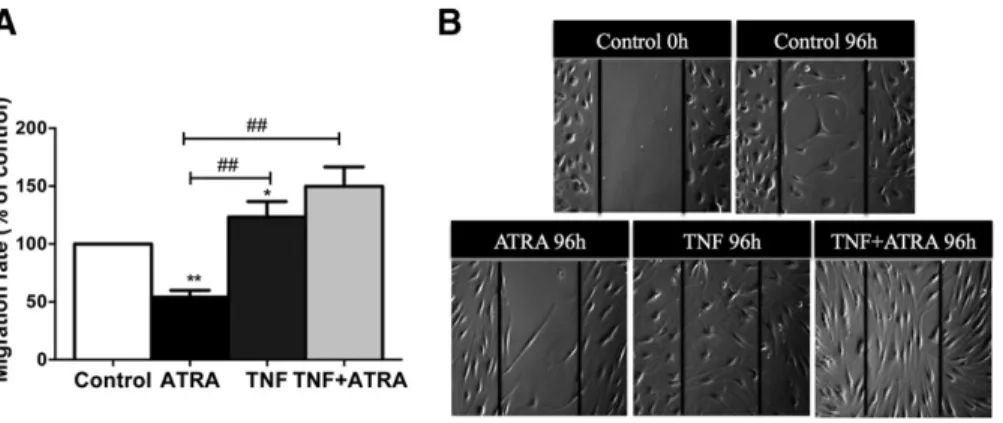 Fig. 2. ATRA reduces RA FLS invasion. (A) Percentage of RA FLS stimulated with or without 5 mM ATRA that invaded the inserts coated with Matrigel