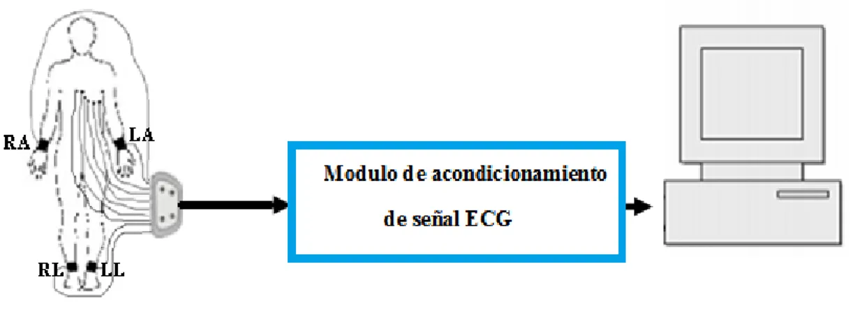 Figura 2.1.  Diagrama en bloque del modulo de acondicionamiento de la señal ECG en Humanos