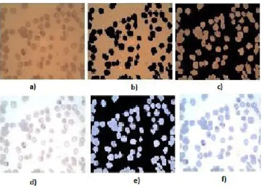 Figura 3.1. Etapas de la normalización del color: (a) entrada de la imagen en RGB, (b) separación de  los  píxeles  del  fondo,  (c)  extracción  de  los  píxeles  del  primer  plano  (I 1 f  r,g,b ),  (d)  normalización  de  la  imagen  de  entrada  por  