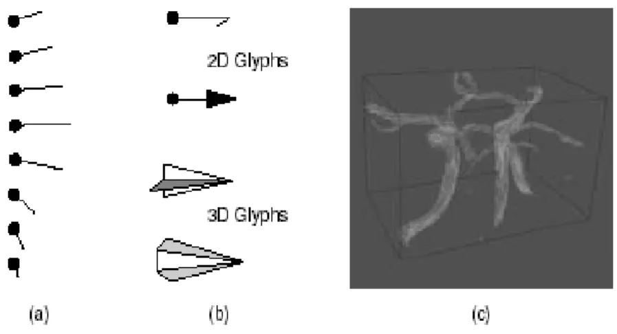 Figura 1.5. Técnicas de visualización vectorial. a) Líneas orientadas; b) Iconos y flechas  orientadas c) Visualización de 167,000 vectores 3D en la región de la arteria carótida 