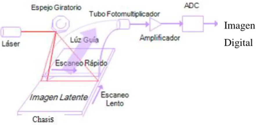 Figura 4. Sistemas de radiografía computarizada, basados en fósforos fotoestimulables [12,  14]