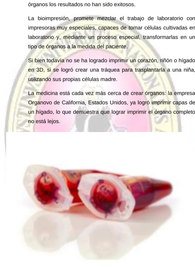 Figura 6: Bioimpresión capas de un hígado 