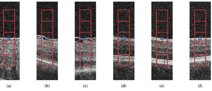 Figure 5. Regions of interest around the ILM layer points represented by the rectangular-shaped window and the five square-shaped windows