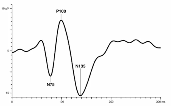Figura 8. Respuesta neuroeléctrica para el VEP de patrón invertido. 