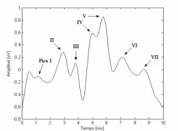 Fig. 13. Morfología de la señal de PEATC. 