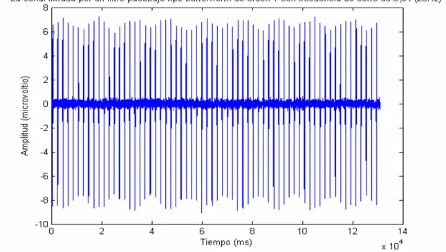 Figura 24. Señal filtrada por el filtro mencionado anteriormente. 