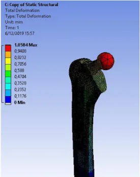 Figura 24-4:  Deformación de la prótesis  carga externa de 6kg