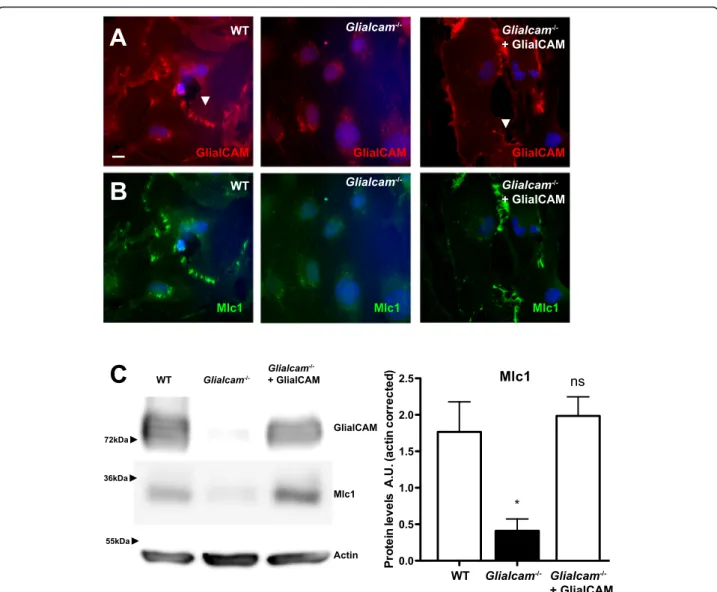 Fig. 5 Mlc1 is mislocalized in primary Glialcam −/− astrocytes. Localization of GlialCAM (a) and Mlc1 (b) in primary astrocytes from wild-type (WT, left), Glialcam −/− (middle) and Glialcam −/− complemented with adenoviruses expressing human GlialCAM (righ