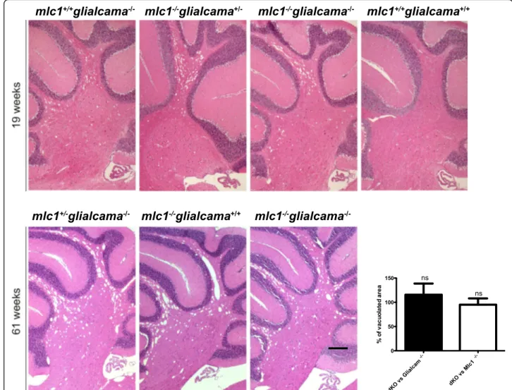 Fig. 3 Myelin vacuolization in Glialcam −/− , Mlc1 −/− and Glialcam −/− Mlc1 −/− mouse models