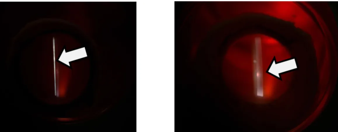 Figura 13. Recuento en microscopio especular.