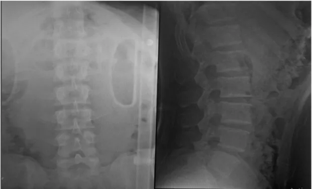 ILUSTRACIÓN 4: Dentro del panel radiográfico de trauma se incluye la RX  Cervical, la imagen nos permite descartar fracturas y/o desplazamientos  vertebrales