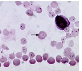 Fig. 1. Fotografía microscópica de frotis de sangre de bovino con los eritrocitos infectados con parásitos  Theileria  annulata  causantes  de  la  piroplasmosis  en  ganado