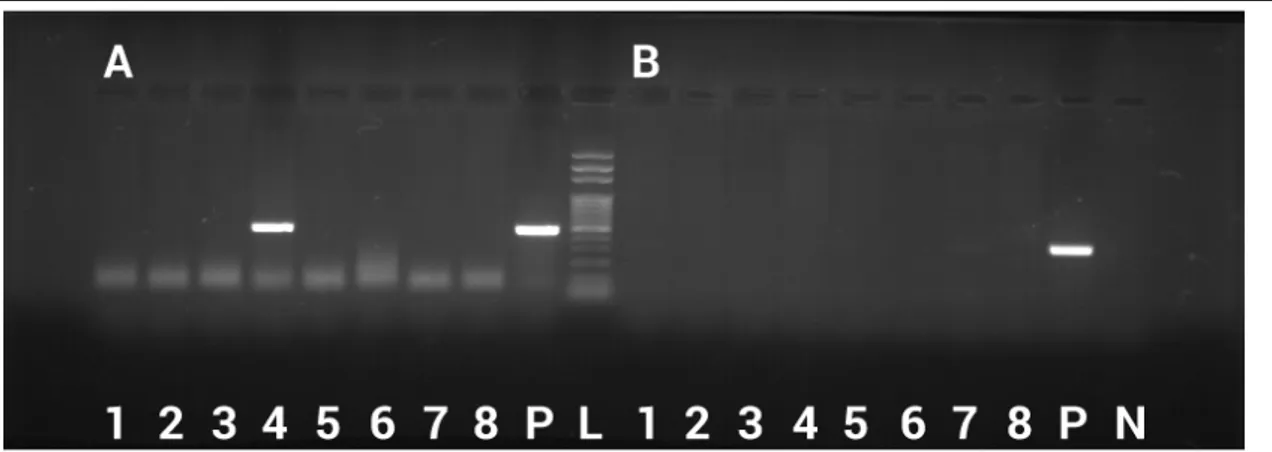 Fig. 4: Electroforesis en gel de agarosa que muestra ADN amplificado para: (A) Babesia spp.; 1-8 muestras  de  animales  con  genoma  amplificado;  P  -  control  positivo;  L  –  100bp  marcador