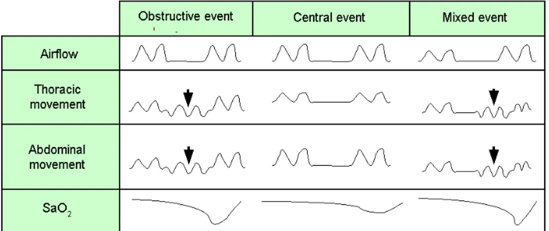 Figure 2.20. Summary of characteristics of the different classes of apneic events 