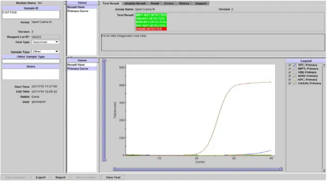 Figura 3. Identificación molecular mediante el GenXpert® de una bacteria productora  de OXA-48