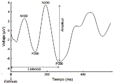 Figure 1. 1. Forma de onda de un Potencial Evocado Auditivo [5]. 