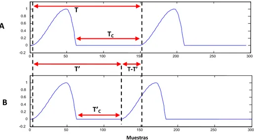 Figura 2.6 (A) Señal de excitación glotal periódica. T representa la duración del pulso y T C  la duración de la  fase de cerrado (B) Señal de excitación glotal contaminada con jitter según el modelo  separación/aproximación