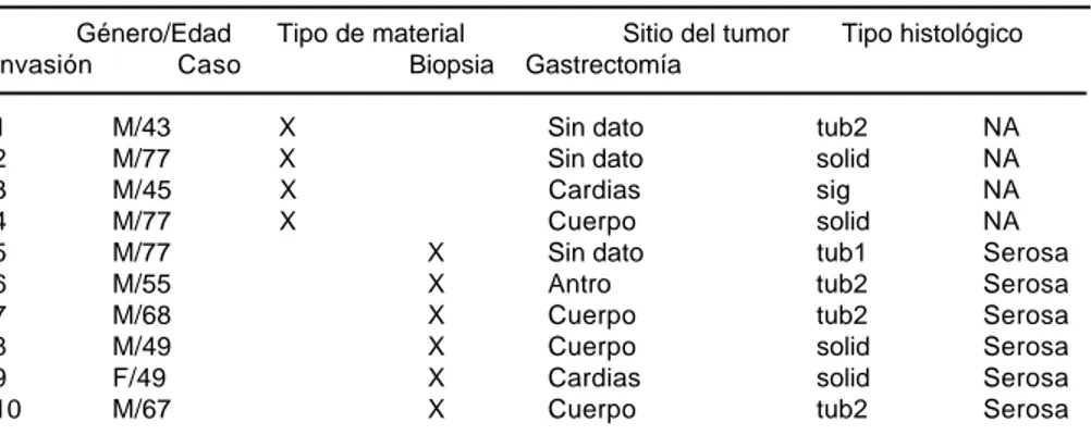 Figura 3. Adenocarcinoma tipo intestinal de variedad bien diferenciada tubular y papilar (3A, hematoxilina-eosina x 100)