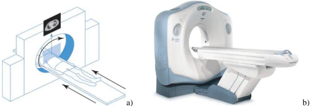 Fig. 1.2 Generaciones representativas de la evolución de la tomografía. 