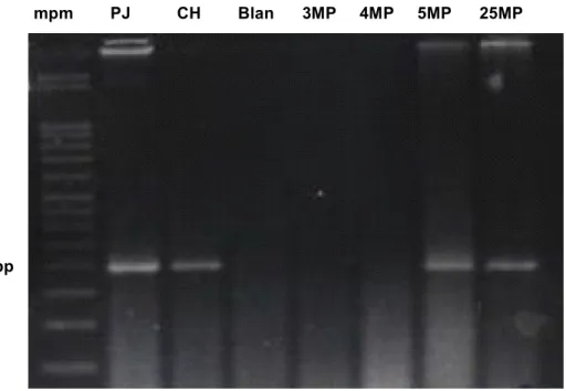 Figure 1. PCR amplification with primers L5054 and H5189, which reveal a 183-pb DNA fragment