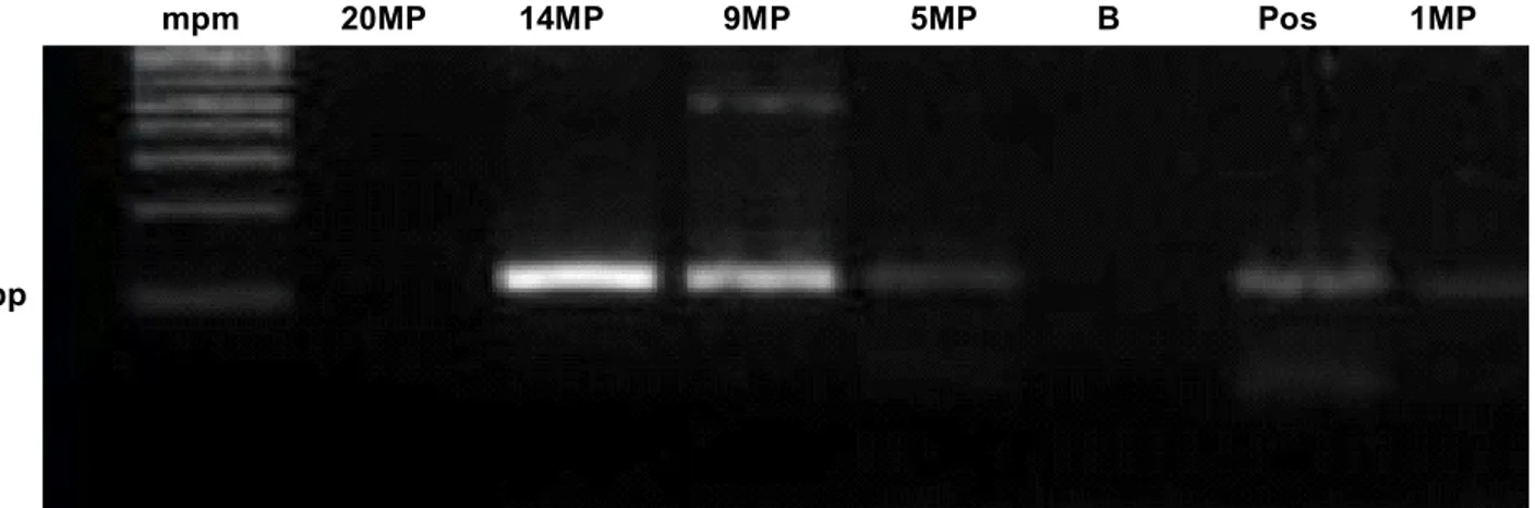 Figure 3. PCR amplification with primers L13257 and H13393, which reveal a 181-pb DNA fragment;