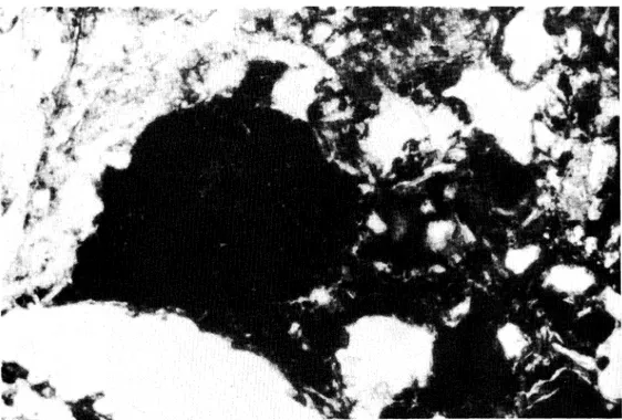 Foto 2. Nódulo de hematites-goethita de forma irregular.